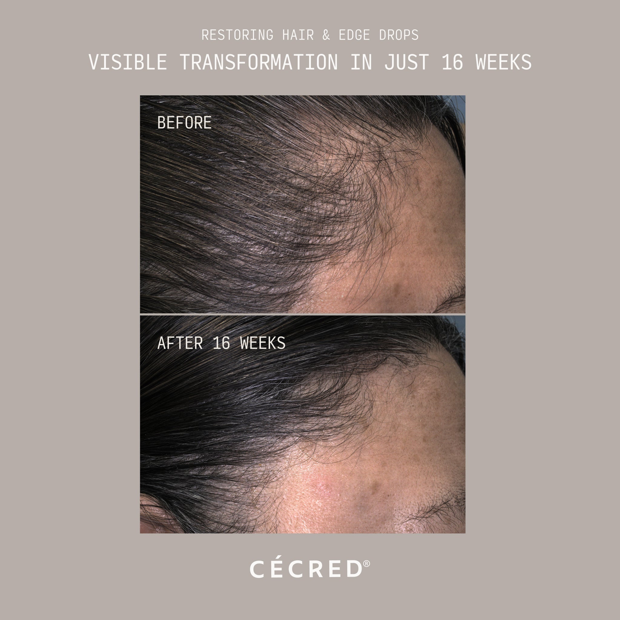 Restoring Hair & Edge Drops XL
