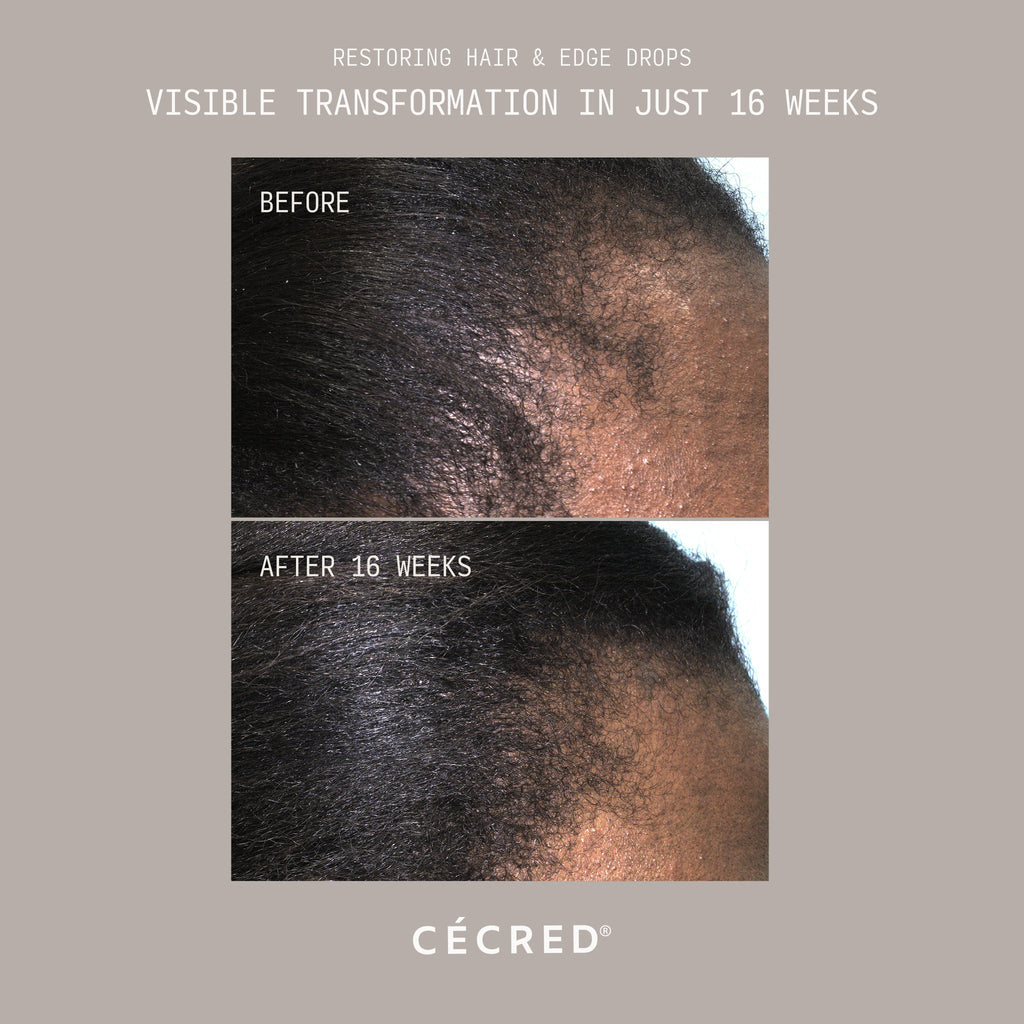 Restoring Hair & Edge Drops XL