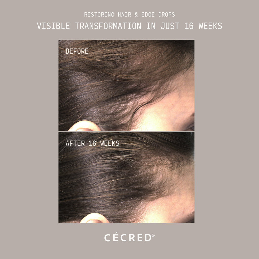 Restoring Hair & Edge Drops XL