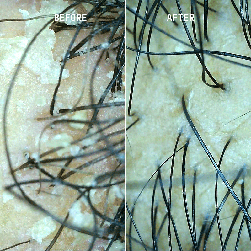 The Scalp Reset & Density Duo