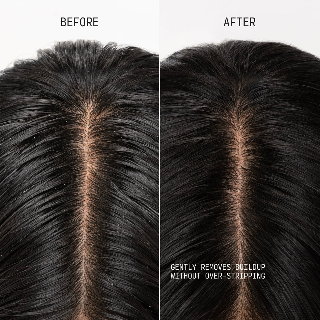 Clarifying Shampoo & Scalp Scrub Max Size