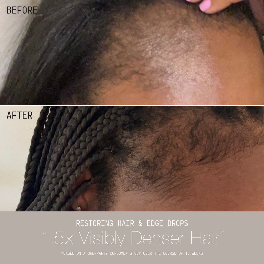 Restoring Hair & Edge Drops