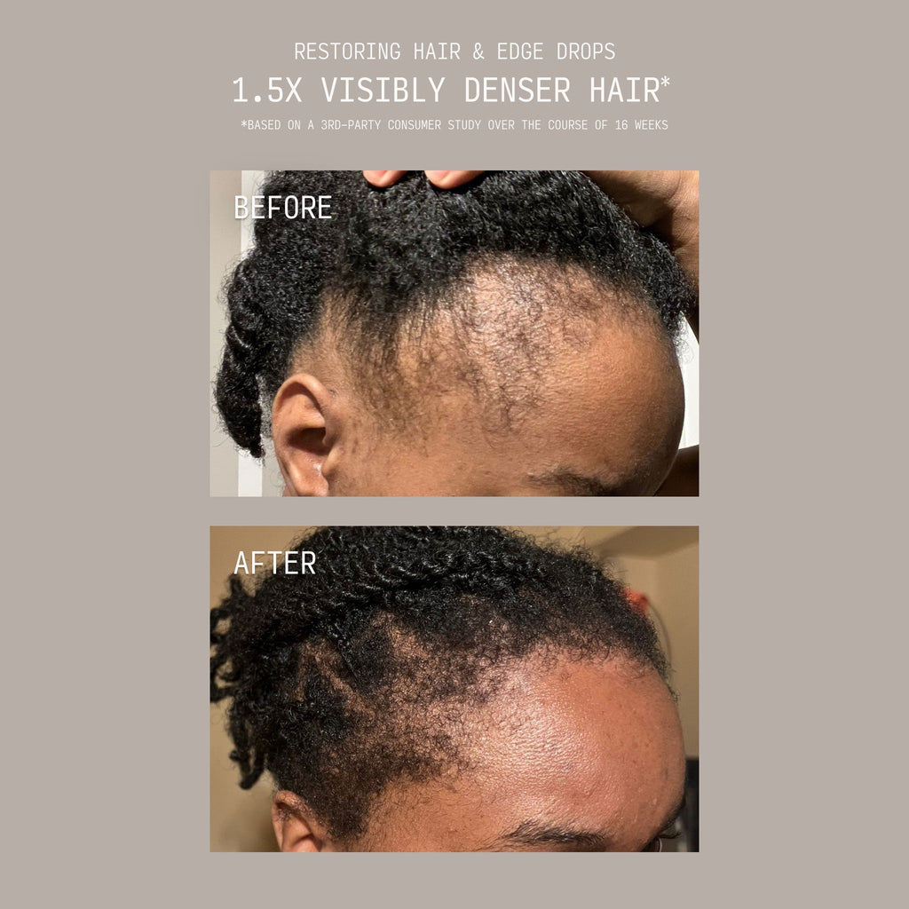 Restoring Hair & Edge Drops