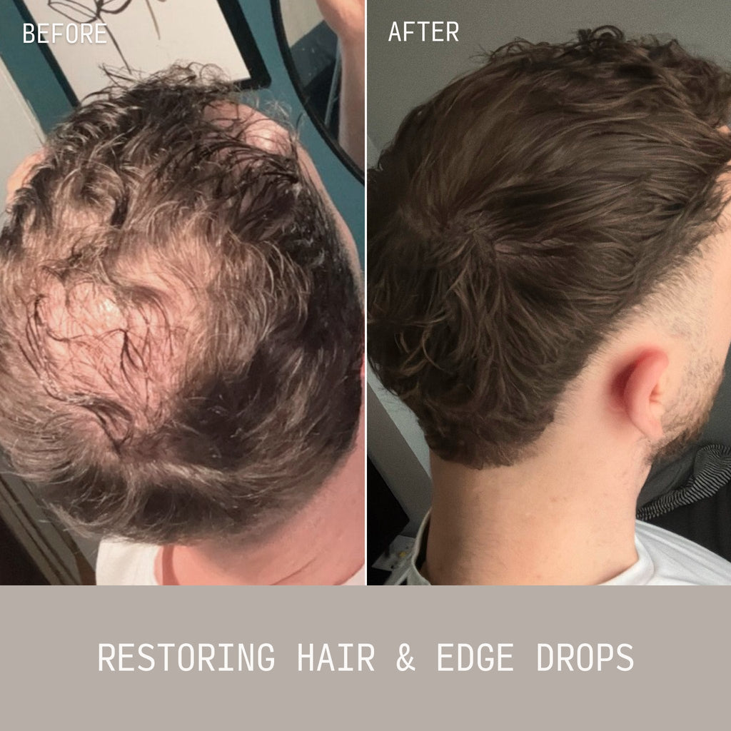 The Scalp Reset & Density Duo